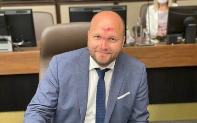 Minister obrany Jaroslav Naď prišiel na rokovanie vlády s krvavým čelom a nosom: proste futbal