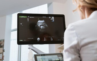 Ministerstvo pozastavilo vývoz pupočníkovej krvi. Masívna kontrola ukázala konkrétne nedostatky