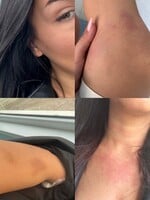 Mišku z Ruže pre nevestu na ulici napadla partnerka jej ex: „Keby nebolo okoloidúcich, zabila by ma“