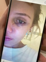 Mladé ženy si s námi promluvily o toxických vztazích: Měl nepředvídatelné výbuchy hněvu, věřila jsem, že je to moje chyba