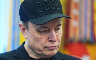 Musk odišiel z Bieleho domu s monoklom na oku. Zranenie mu spôsobil jeho päťročný syn