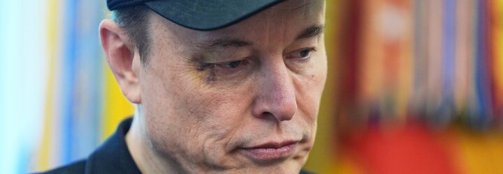 Musk odišiel z Bieleho domu s monoklom na oku. Zranenie mu spôsobil jeho päťročný syn