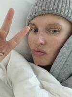 Mutácia v géne BRCA: Angelina Jolie prišla o prsníky aj vaječníky, modelke Biance Balti sa rakovina nevyhla ani po mastektómii