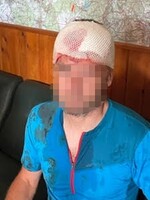 Na Donovaloch na horského záchranára zaútočil medveď