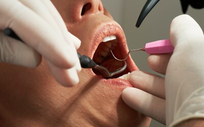 Na Slovensku je čoraz viac falošných zubných technikov. Pre pacientov môže ísť o vážne ohrozenie chrupu