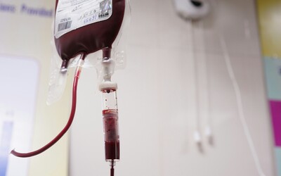Na Slovensku máme hraničné zásoby jednej krvnej skupiny. Národná transfúzna služba žiada o pomoc