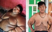 Najtučnejší chlapec na svete schudol na nepoznanie. Ako 9-ročný vážil takmer 200 kíl, nevedel sám chodiť, stáť ani jesť 