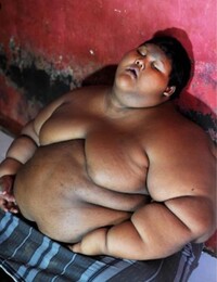 Najtučnejší chlapec na svete schudol na nepoznanie. Ako 9-ročný vážil takmer 200 kíl, nevedel sám chodiť, stáť ani jesť 