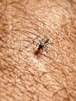 Nič nie je také efektívne ako sieťky proti komárom, hovorí odborník. Zisťovali sme, ako môžeš prežiť leto bez štípancov