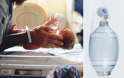 Novorodenec v Austrálii zomrel hodinu po narodení. Namiesto kyslíka ho pripojili na rajský plyn