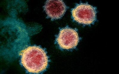 Nový koronavirus SARS-CoV-2 nebyl vytvořen v laboratoři, prokázali vědci