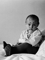 Obrazem: Dojemné fotky dětí z Černobylu. Uplynulo 37 let od největší jaderné katastrofy lidstva 