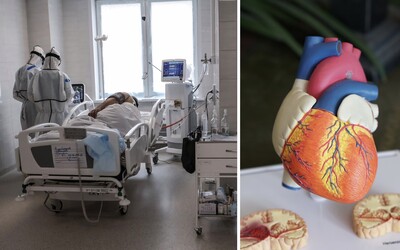 Pacienti s prekonaným COVID-19 môžu mať poškodené srdce aj v prípade, že nikdy nepotrebovali hospitalizáciu