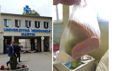 Pacientka nedostala v slovenskej nemocnici ani tanier. Chlieb, šunku, jablko a odbalené maslo dostala v sáčku