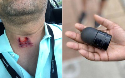 Policista v USA střelil reportéra během rozhovoru přímo do krku gumovým projektilem