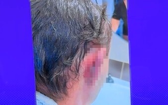 Polícia v Trenčíne mužovi skoro odtrhla ucho, druhého donútili vyzliecť sa a dobili ho. Demokrati upozorňujú na nové vážne prípady