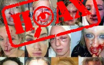 Polícia vyvrátila hoax o fotografiách zbitých žien, ktoré údajne napadli utečenci