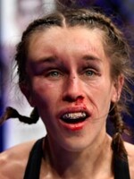 Poľská UFC bojovníčka, ktorej tvár pri poslednom zápase opuchla k nepoznaniu, sa zotavila