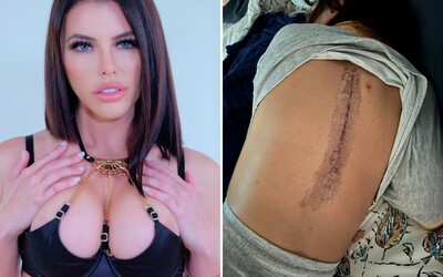 Pornoherečka a streamerka Adriana Chechik si pri bitke v pene škaredo zlomila chrbticu. Pre brutálny úraz prišla o dieťa