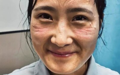 Pot, otlaky na tváři a vyčerpání: Takto vypadají zdravotní sestry, které pečují o pacienty nakažené koronavirem v Číně