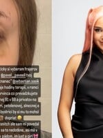 Raperka Luisa v šou Ruža pre nevestu prehovorila o domácom násilí. Jej bývalý partner bol vraj pasák