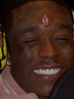 Rapper Lil Uzi Vert si nechal do čela implantovať ružový diamant v hodnote 24 miliónov dolárov