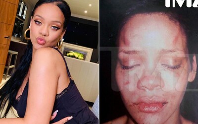 Rihanna darovala miliony dolarů obětem domácího násilí, zažila ho na vlastní kůži