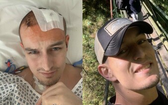 Robo má nevyliečiteľný nádor na mozgu. Nechce peniaze, ani umelé predlžovanie života. Telo ponúkol vedcom (Rozhovor)