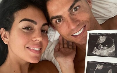 Ronaldo prvýkrát prehovoril o smrti syna, ktorý zomrel pri pôrode