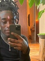 Růžový diamant je zpět! Lil Uzi Vert si ho opět nechal implantovat do čela 