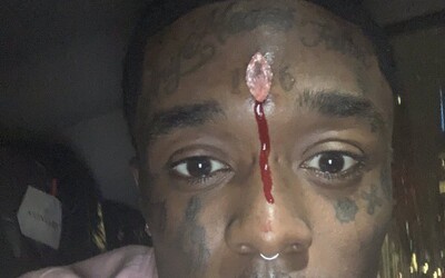 Růžový diamant uprostřed čela Lil Uziho za 24 milionů dolarů ho prý ohrožuje na životě. Začala mu téct krev