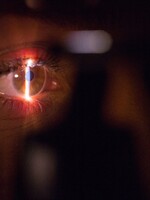 SÚŤAŽ: Vyplň tento 3-minútový dotazník a vyhraj laserovú operáciu očí za 1 600 eur zadarmo