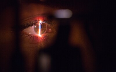 SÚŤAŽ: Vyplň tento 3-minútový dotazník a vyhraj laserovú operáciu očí za 1 600 eur zadarmo
