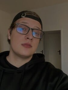 Samuel žije s Visual snow syndrómom: Nemôžem ísť na nákup, pozrieť si film ani si nájsť prácu