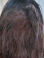 Simona si chcela predĺžiť vlasy, na hlave jej zostal lepkavý chumáč. „Na vlasoch sa šetriť neoplatí,“ vraví kaderník Ján Molnár