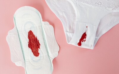 Skotsko: Úředník pro důstojnou menstruaci je cis muž. To je snad vtip, říkají ti, kteří skutečně menstruují
