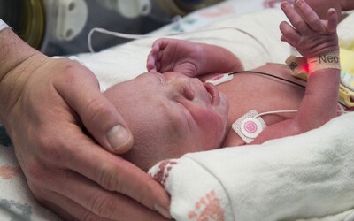 Slovenka s koronavírusom porodila zdravého chlapca. Rodička mala nasadené rúško, zdravotníci ochranné obleky