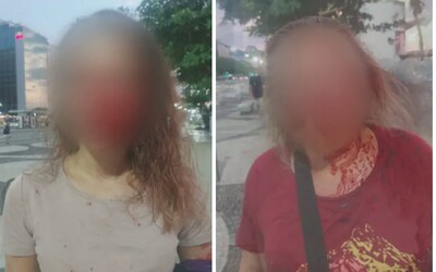 Slovenky počas dovolenky v Brazílii prežili drsný útok. Dvaja tínedžeri ich zmlátili do krvi, pretože im ženy odmietli dať peniaze