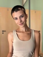 Speváčka Anežka Binková o živote s alopéciou:  Negatívne narážky na môj vzhľad nikdy nemali deti, ale dospelí ľudia