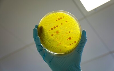 Superodolné baktérie, na ktoré nefungujú antibiotiká, by do roku 2050 mohli zabiť desiatky miliónov ľudí. Upozorňujú na to vedci