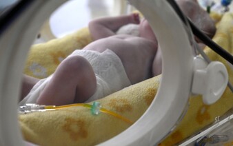 Světový den předčasně narozených dětí: V Česku se nedonošené miminko narodí každou hodinu