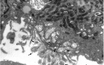 Takto vyzerá koronavírus slovenských pacientov pod mikroskopom