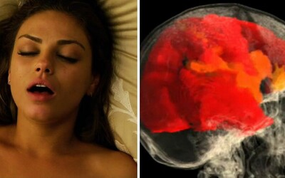 Takto vypadá ženský mozek při orgasmu: Rozkoš zablokovala bolest u žen s poškozenou míchou, které poprvé od nehody vyvrcholily