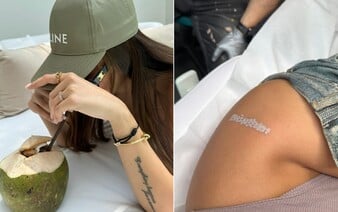 Tetovania si odstraňujú influenceri aj uchádzači o prácu v polícii. Niektorým sa zdá bolesť 10-krát horšia ako pri tetovaní