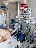 V Česku je nyní více hospitalizovaných v těžkém stavu, než byl na jaře nejvyšší celkový počet nakažených v nemocnicích
