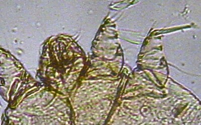 V Itálii se šíří nebezpečné infekční onemocnění. Počet případů vzrostl o stovky procent