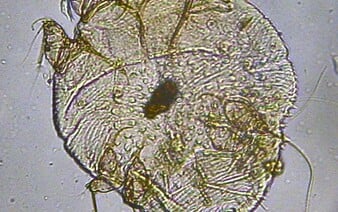 V Taliansku sa šíri nebezpečné infekčné ochorenie. Počet prípadov stúpol až sedemnásobne