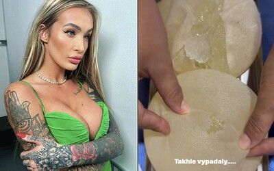 VIDEO: Bývalej českej pornoherečke Daisy Lee praskli silikóny. Operáciu musela podstúpiť v džungli, vyšla ju poriadne draho