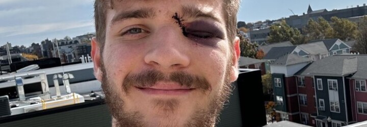 VIDEO: Desivé zranenie v NHL. Čech takmer prišiel na ľade o oko, protihráč ho porezal korčuľou