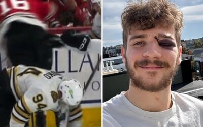 VIDEO: Desivé zranenie v NHL. Čech takmer prišiel na ľade o oko, protihráč ho porezal korčuľou